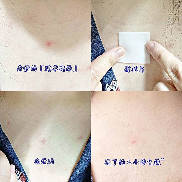 ACROPPASS肌膚急救貼(6組1盒)34.jpg ACROPPASS肌膚急救貼(6組1盒)34.jpg